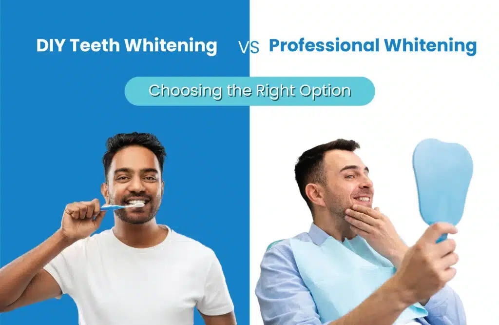 Hydrogen peroxide for teeth whitening: Professional VS. DIY Whitening