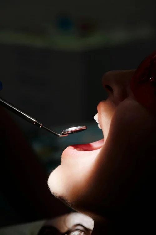 Teeth whitening enhances one's appearance and boosts confidence.