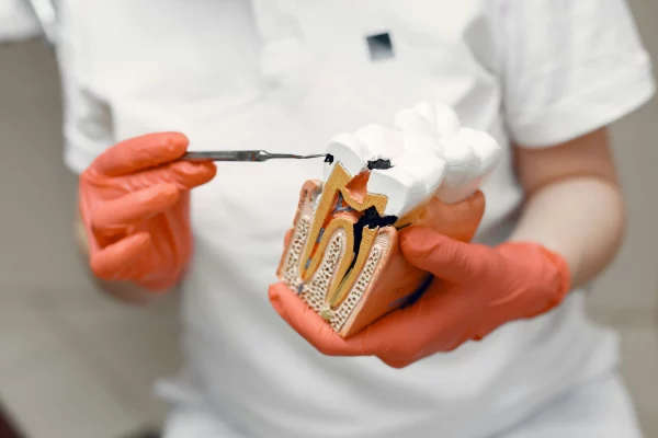 Root Canal treatment can save your damaged teeth.