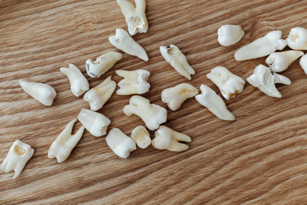 DIY teeth whitening and the science behind tooth enamel.