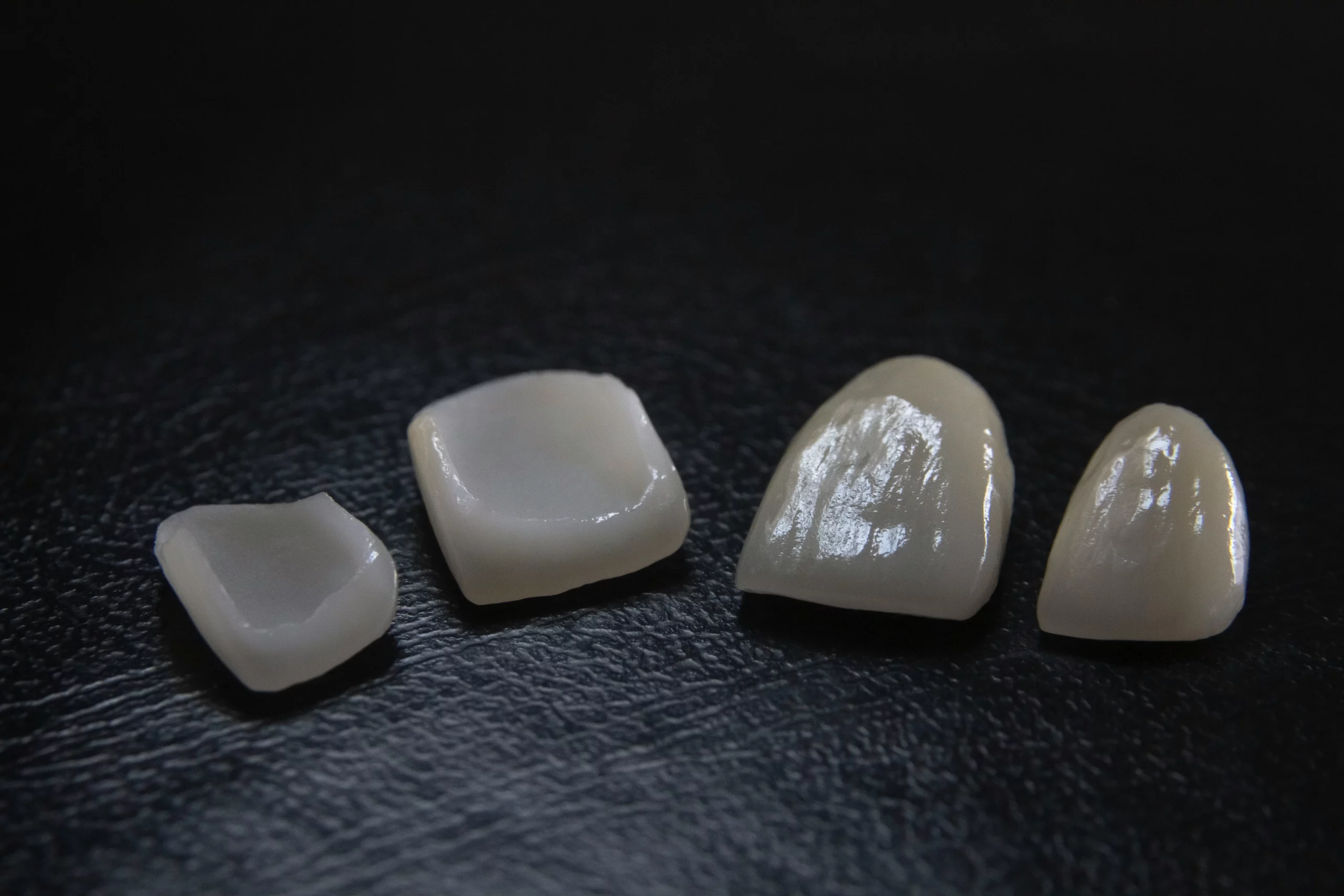 Why should you consider dental veneers?