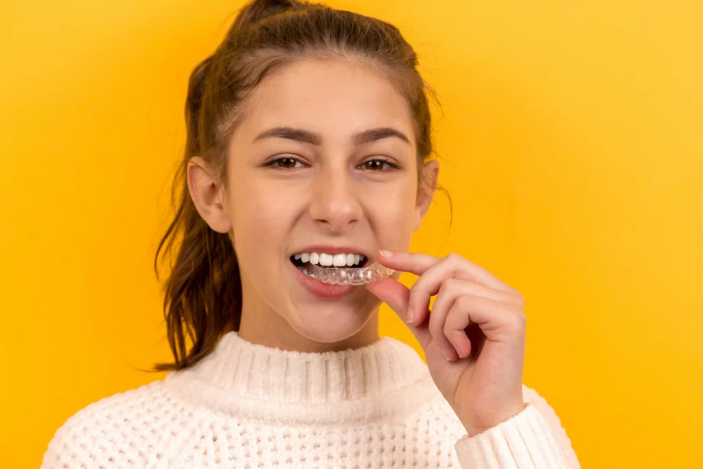 Invisalign: What to expect?