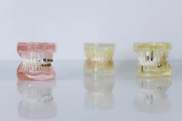 Affordable dental implant.