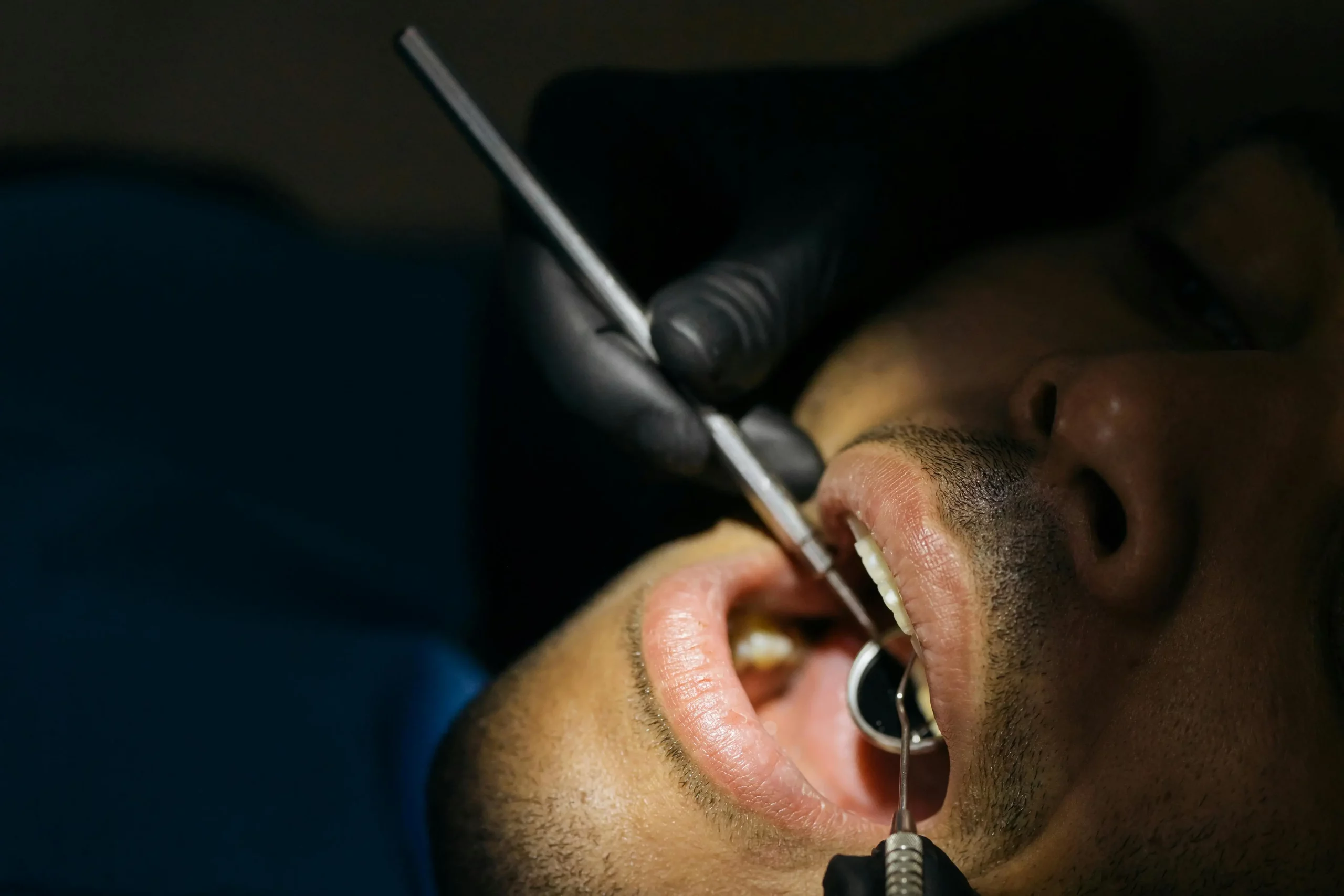During a dental emergency exam.