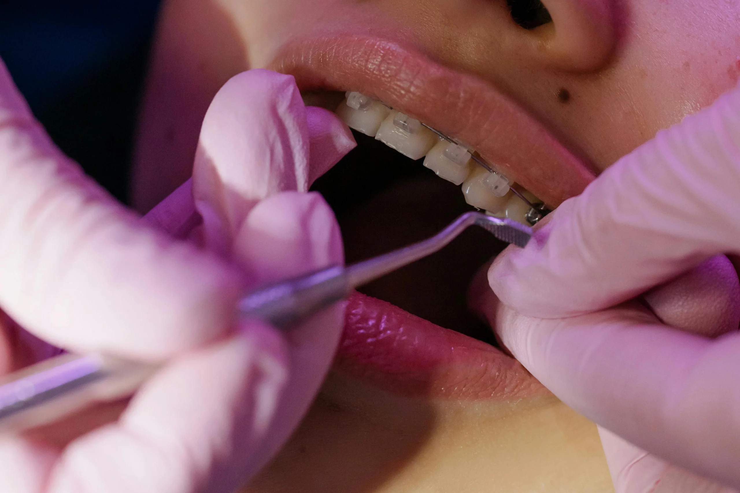 Oral hygiene routine. 