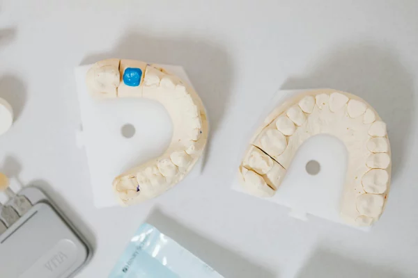 Know why dental crowns are big help.