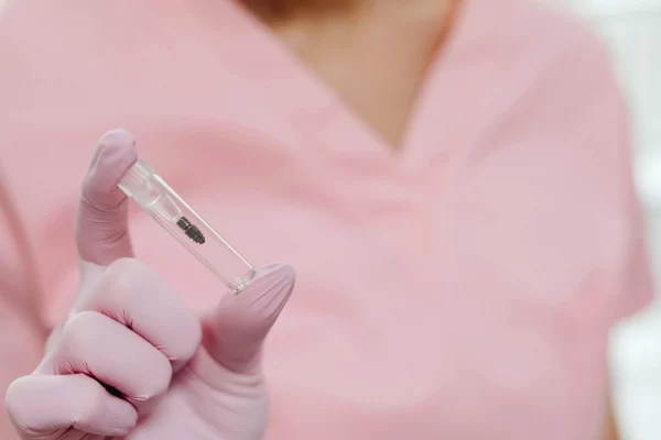 Things you need to know about dental implants.