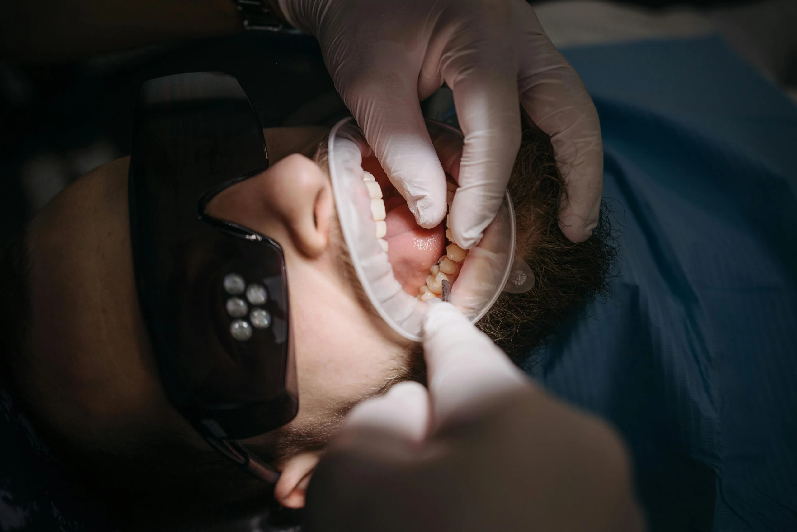 Gum disease can affect your heart.