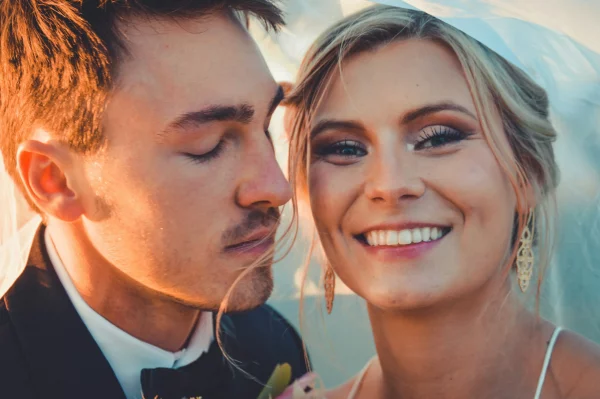 Invisalign for your wedding preparation.