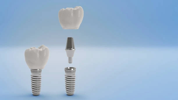 Dental implants and autoimmune diseases.