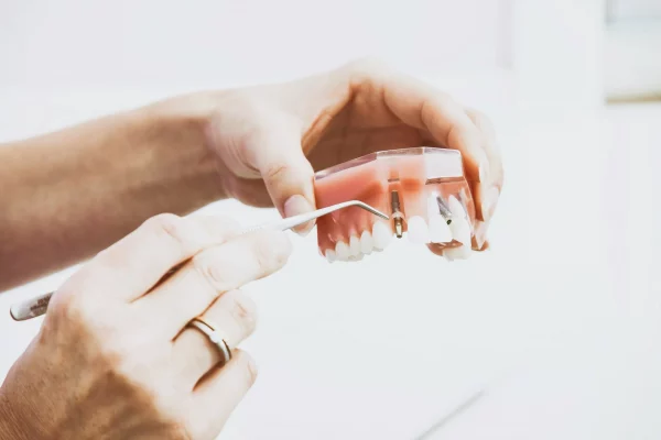 Same-Day Dental Implants: Can You Get Teeth in One Visit?
