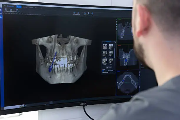 dental 3D imaging technology