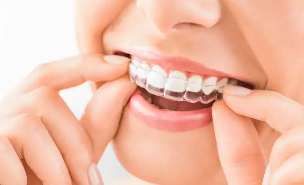 Invisalign Ignites Your Radiant, Fearless First Impressions