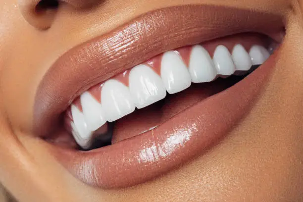 Teeth Whitening Breakthrough Transforms Smiles at Graham Park