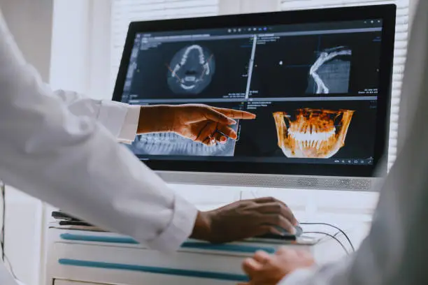 dental x-ray on screen